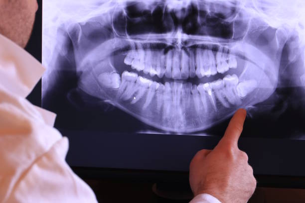 Best Emergency Dentist for Special Needs Patients in Williamsburg, PA