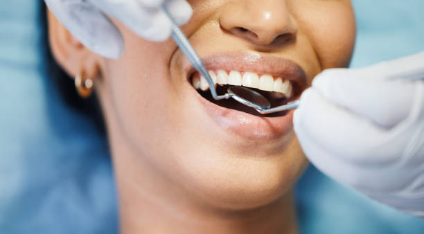 Best Emergency Dental Extractions in Williamsburg, PA